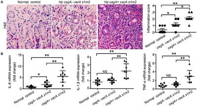 Helicobacter pylori CagA Protein Negatively Regulates Autophagy and Promotes Inflammatory Response via c-Met-PI3K/Akt-mTOR Signaling Pathway